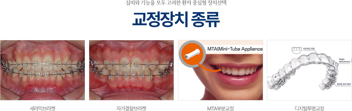 교정장치 종류