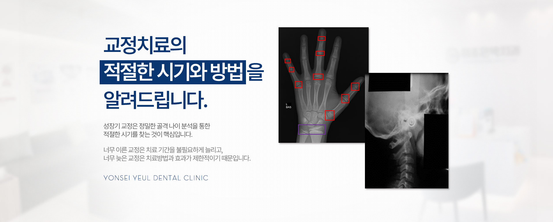 교정치료의 적절한 시기와 방법을 알려드립니다.  